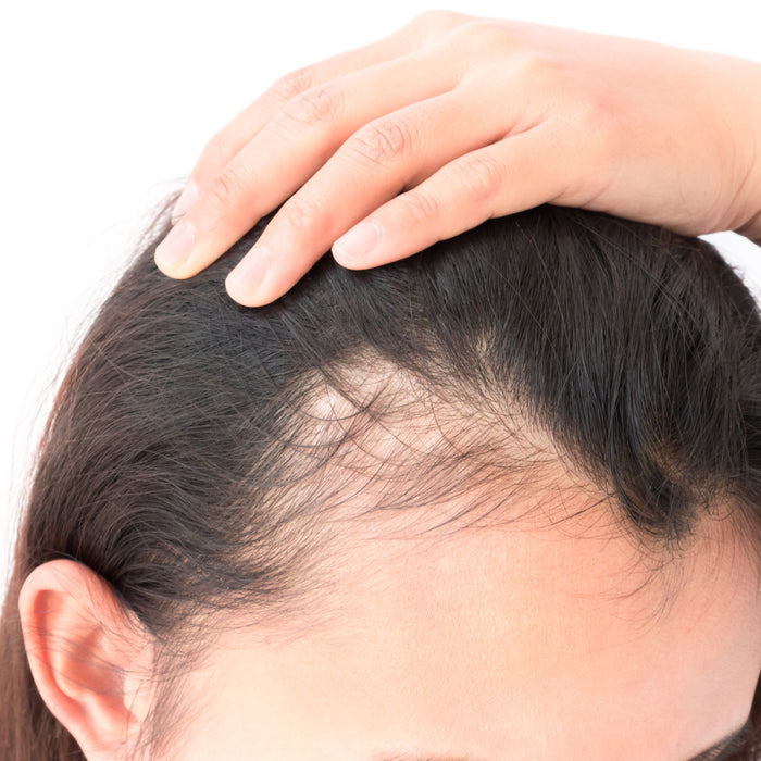 Dr Mike Forsythe on Hair Loss and Its Causes