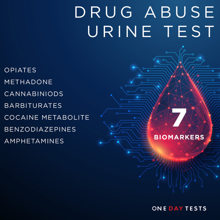 Drug Abuse Urine Test