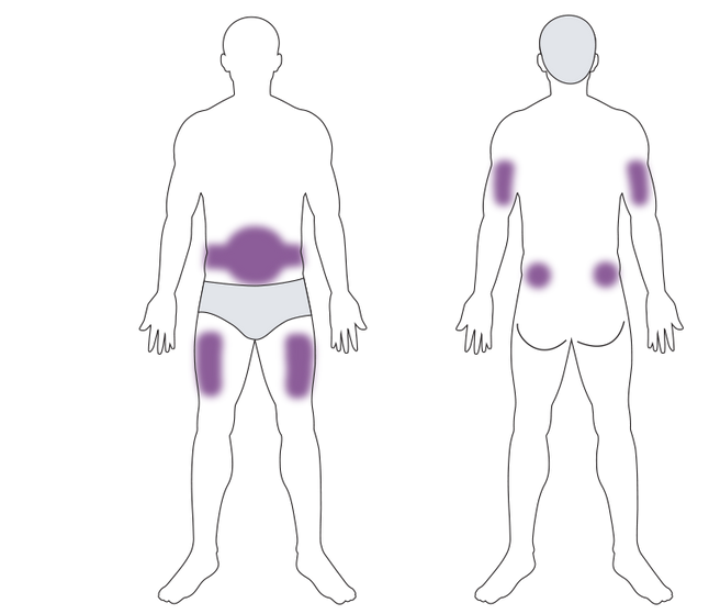 IDENTIFY THE INJECTION SITE