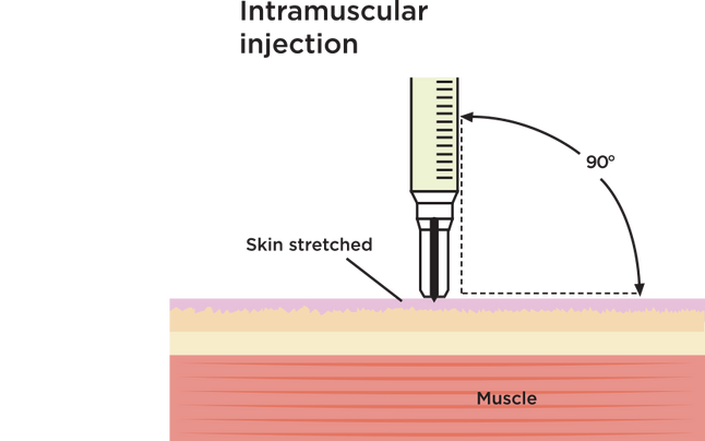 STEP 14 - INTRAMUSCULAR INJECTION