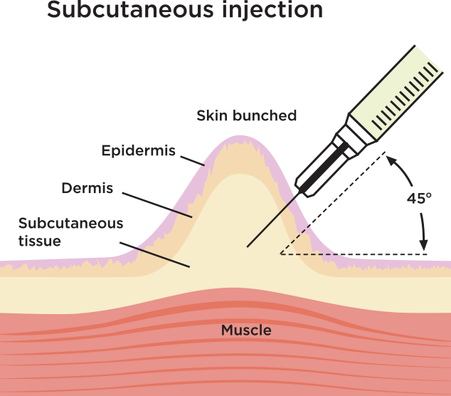 Subcutaneous (SC) Self-Injection Instructions — onedaytests.com