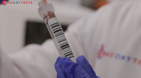 Eosinophils (EOS) - description and reference ranges — onedaytests.com