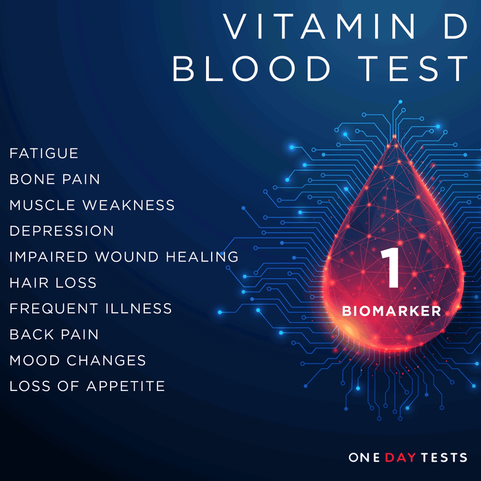 Vitamin D (25-OH) Blood Test