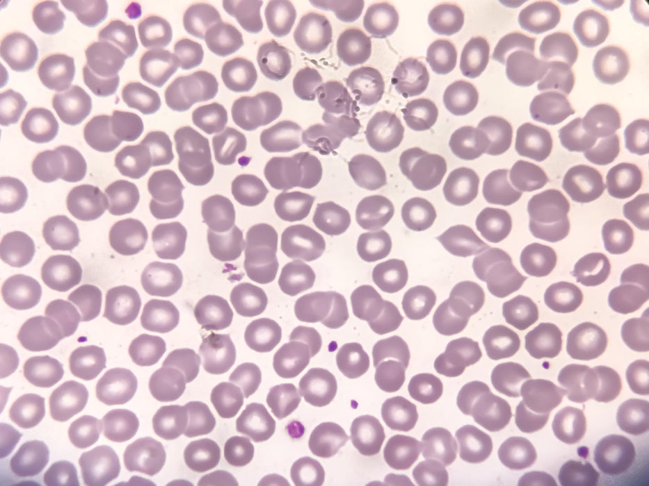 Blood film analysis and differential count